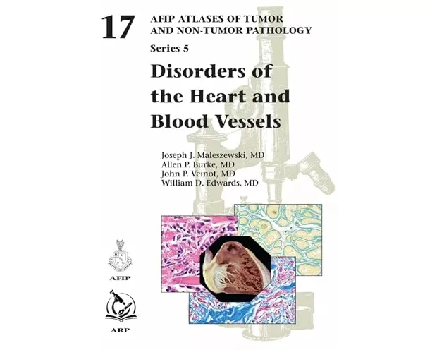 Disorders of the Heart and Blood Vessels