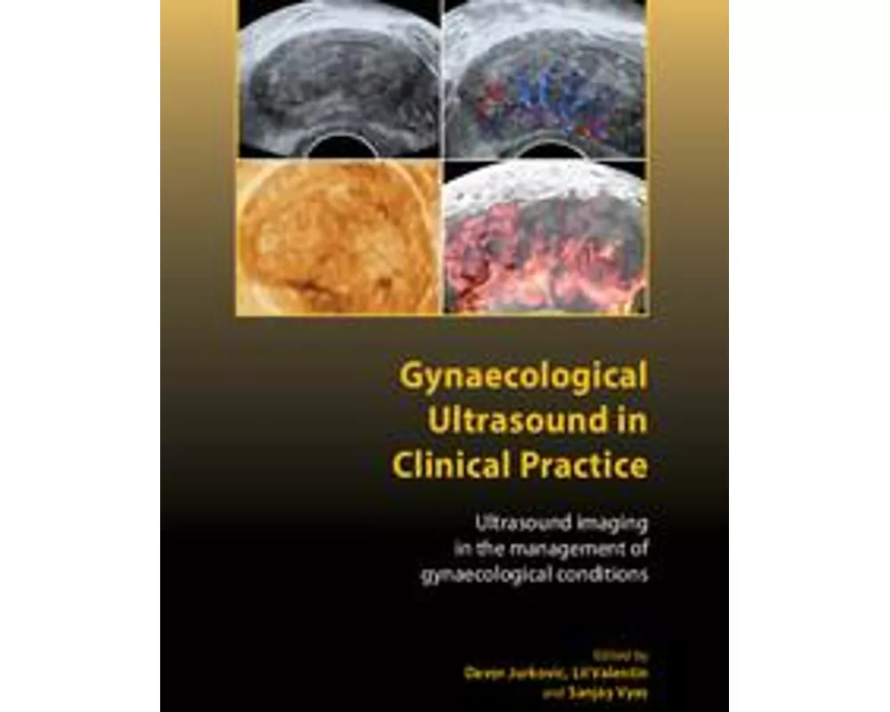 Gynaecological Ultrasound in Clinical Practice