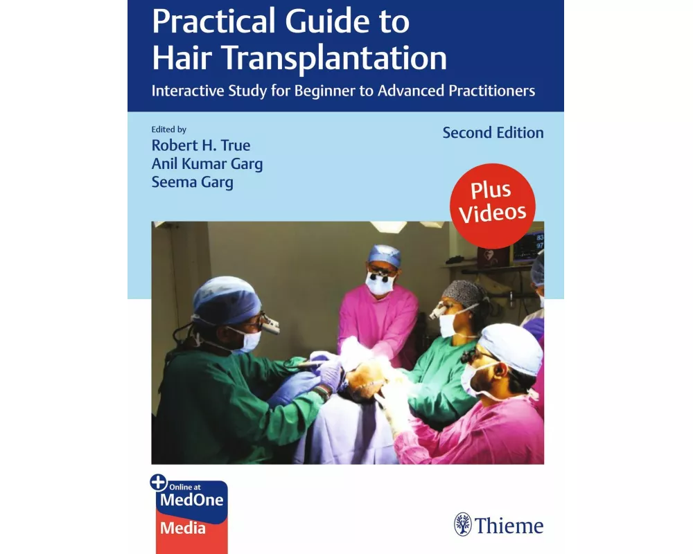 Practical Guide to Hair Transplantation