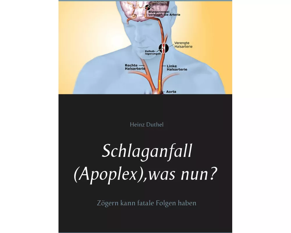 Schlaganfall (Apoplex), was nun?