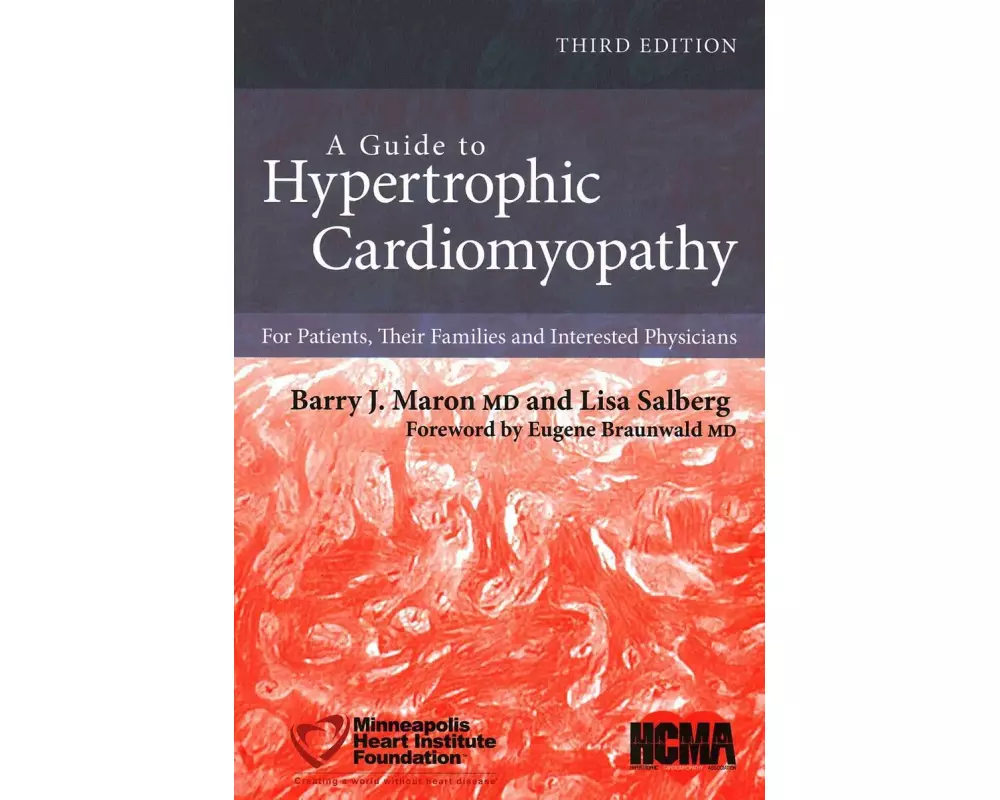 A Guide to Hypertrophic Cardiomyopathy