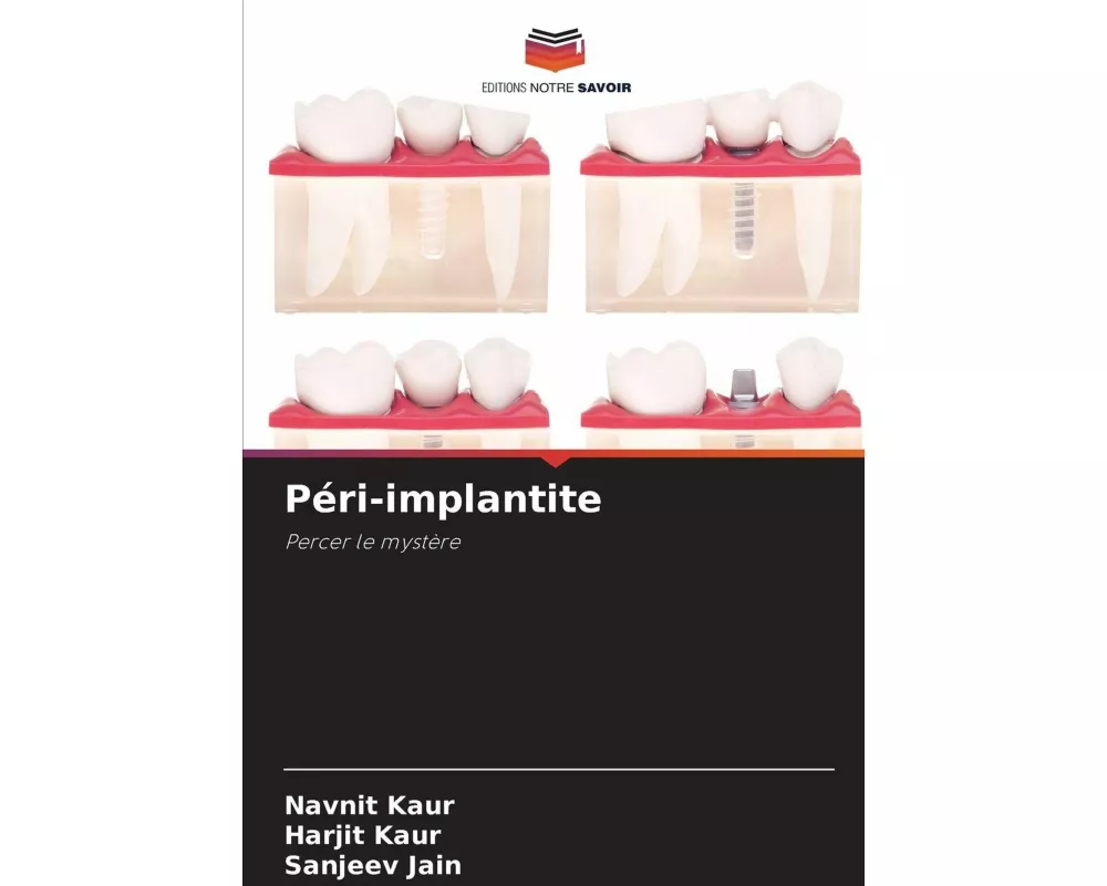 Péri-implantite