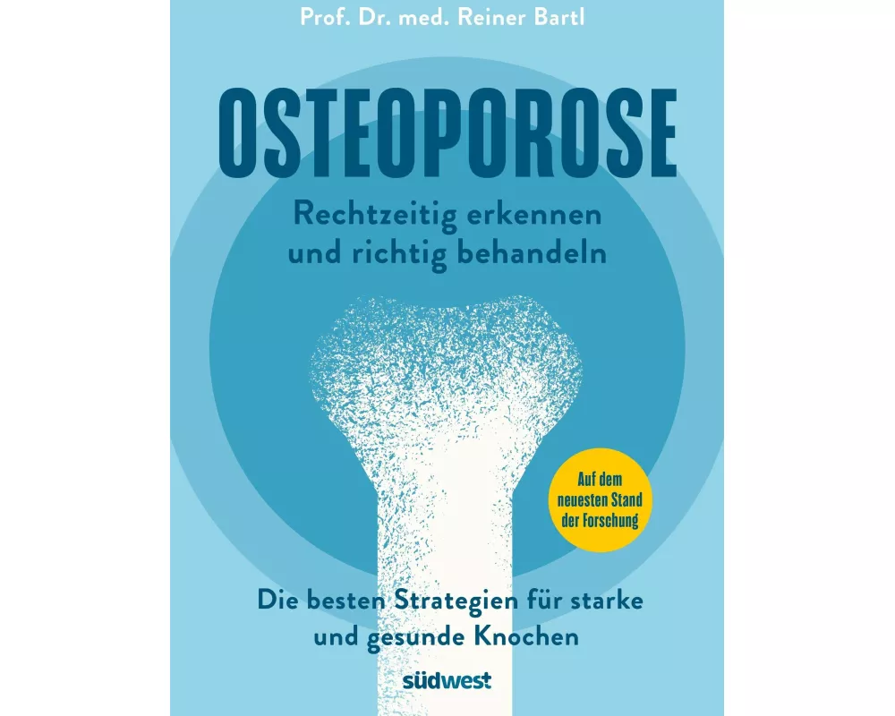 Osteoporose rechtzeitig erkennen und behandeln