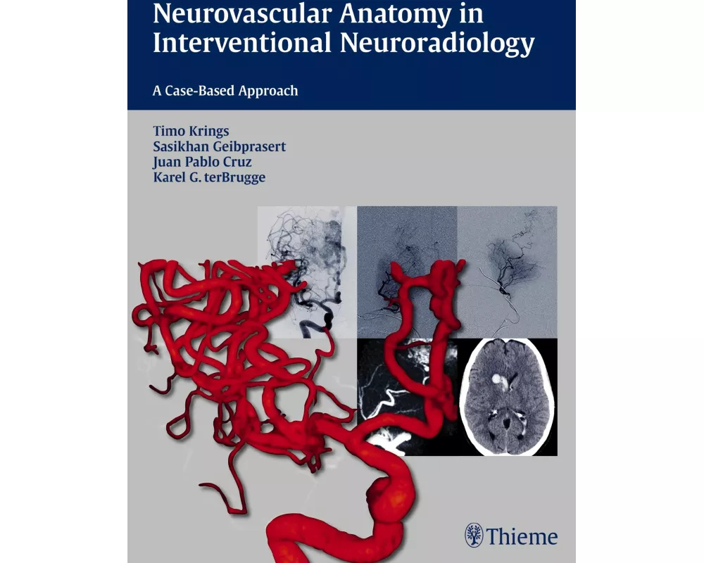 Neurovascular Anatomy in Interventional Neuroradiology