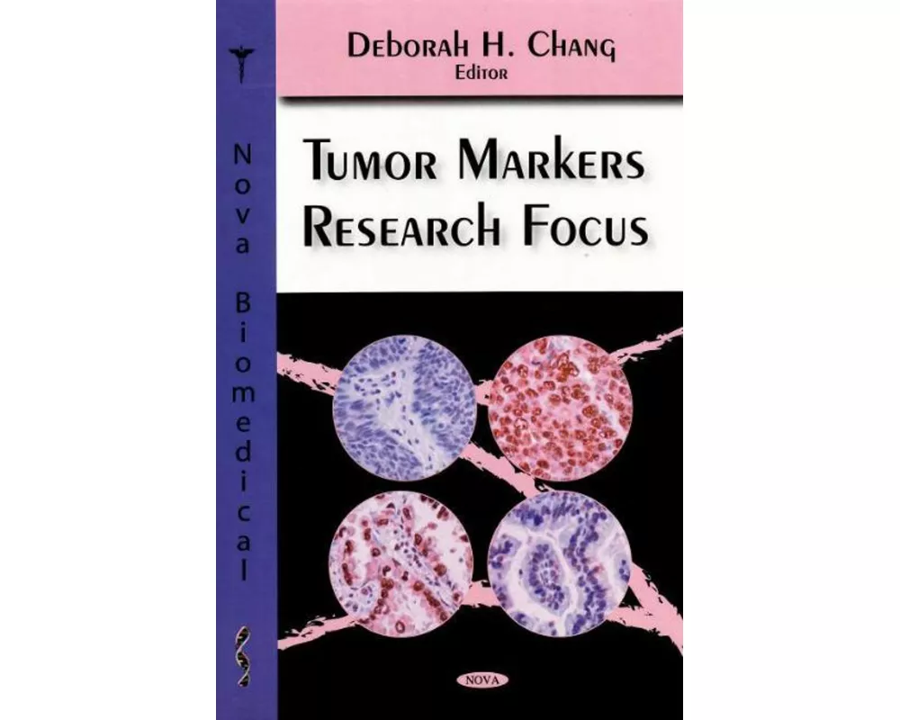 Tumor Markers Research Focus