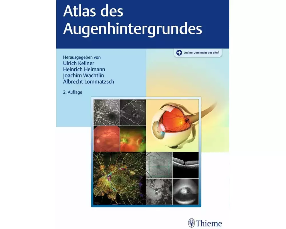 Atlas des Augenhintergrundes