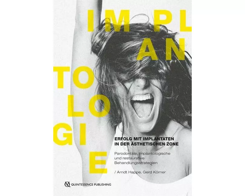 Erfolg mit Implantaten in der ästhetischen Zone