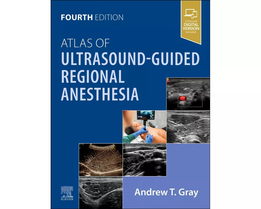 Atlas of Ultrasound-Guided Regional Anesthesia