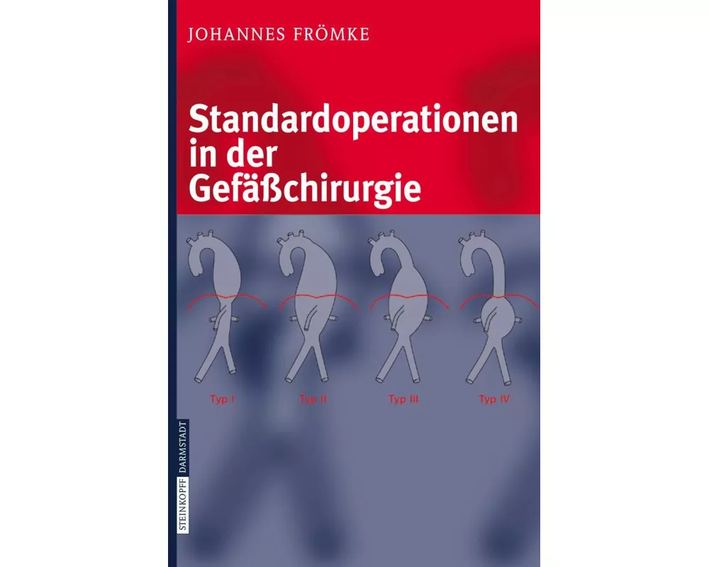 Standardoperationen in der Gefäßchirurgie