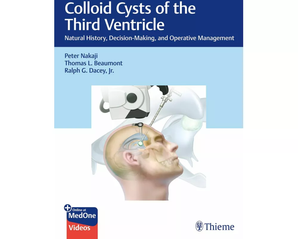 Colloid Cysts of the Third Ventricle