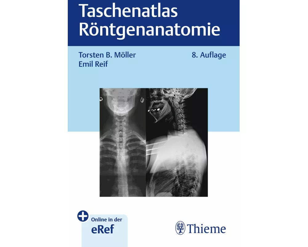 Taschenatlas Röntgenanatomie
