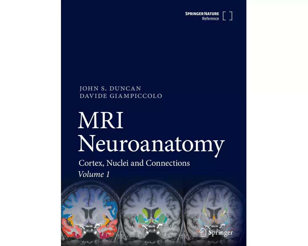 MRI Neuroanatomy
