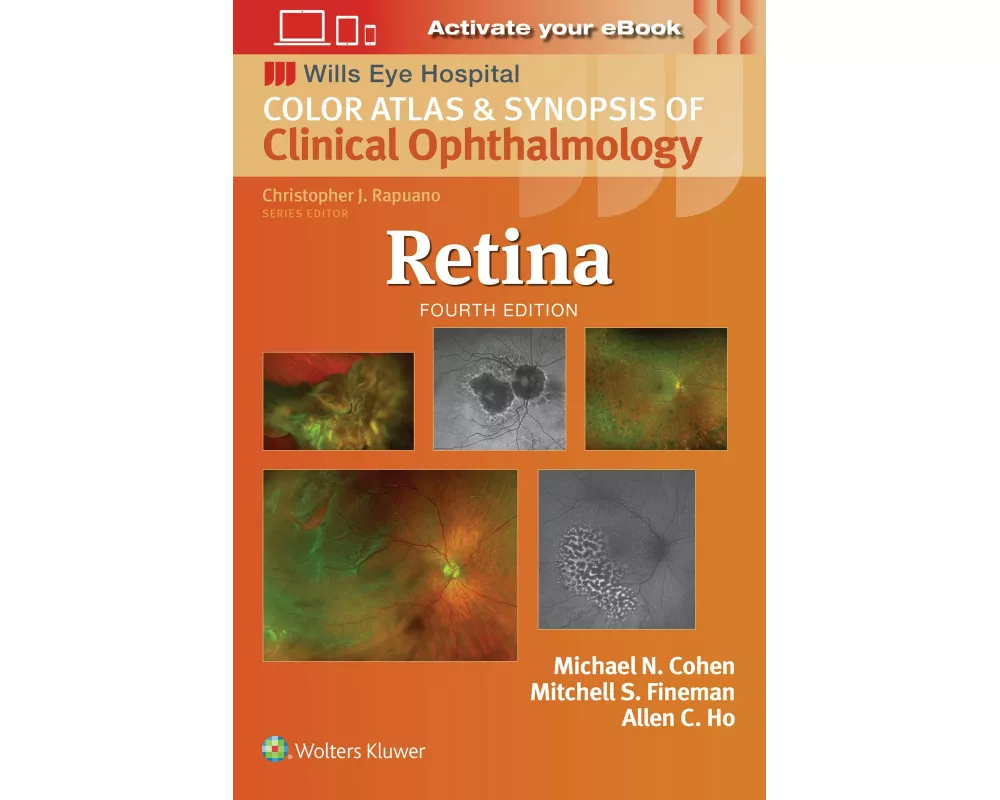 Retina