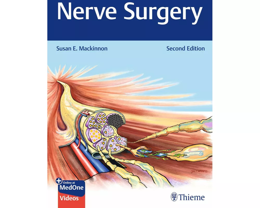 Nerve Surgery