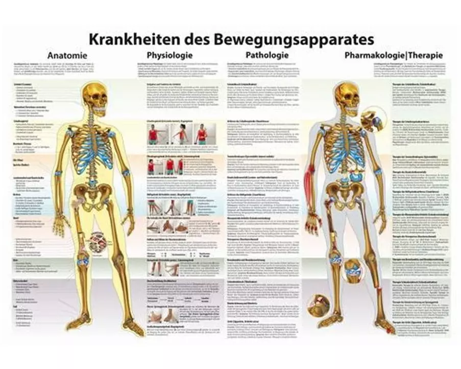Rüdiger Krankheiten des Bewegungsapparates 50 x 70 cm