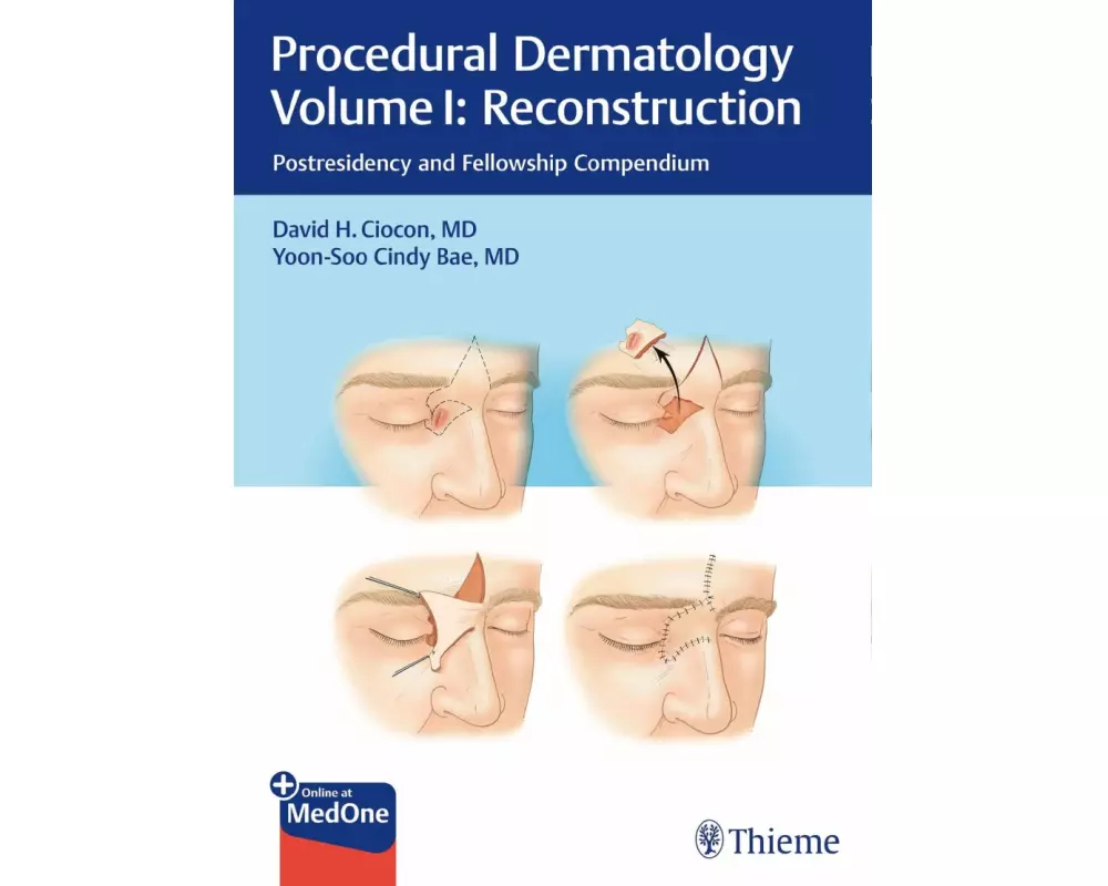 Procedural Dermatology Volume I: Reconstruction