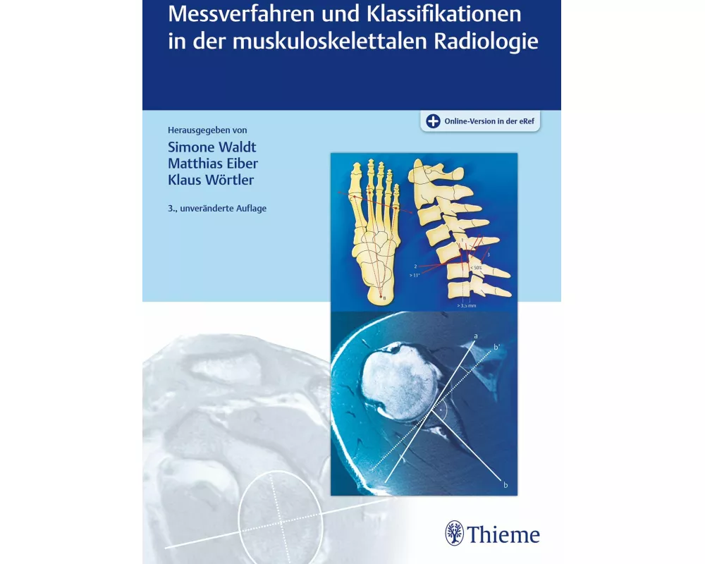 Messverfahren und Klassifikationen in der muskuloskelettalen Radiologie
