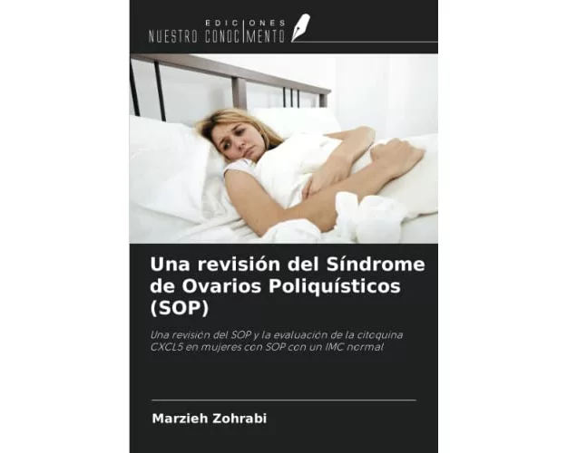 Una revisión del Síndrome de Ovarios Poliquísticos (SOP)