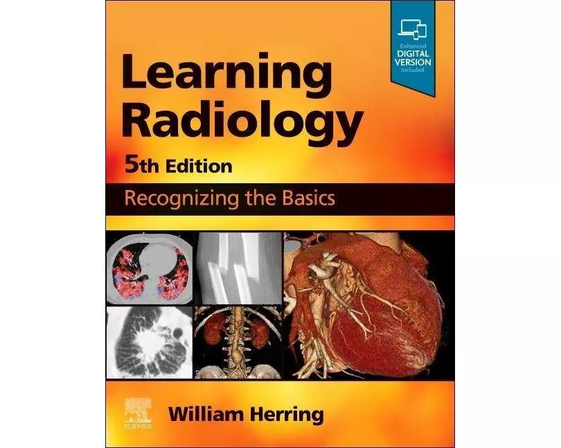 Learning Radiology