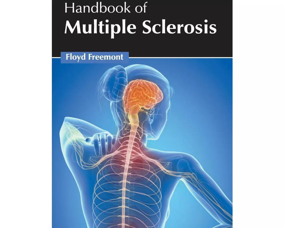 Handbook of Multiple Sclerosis