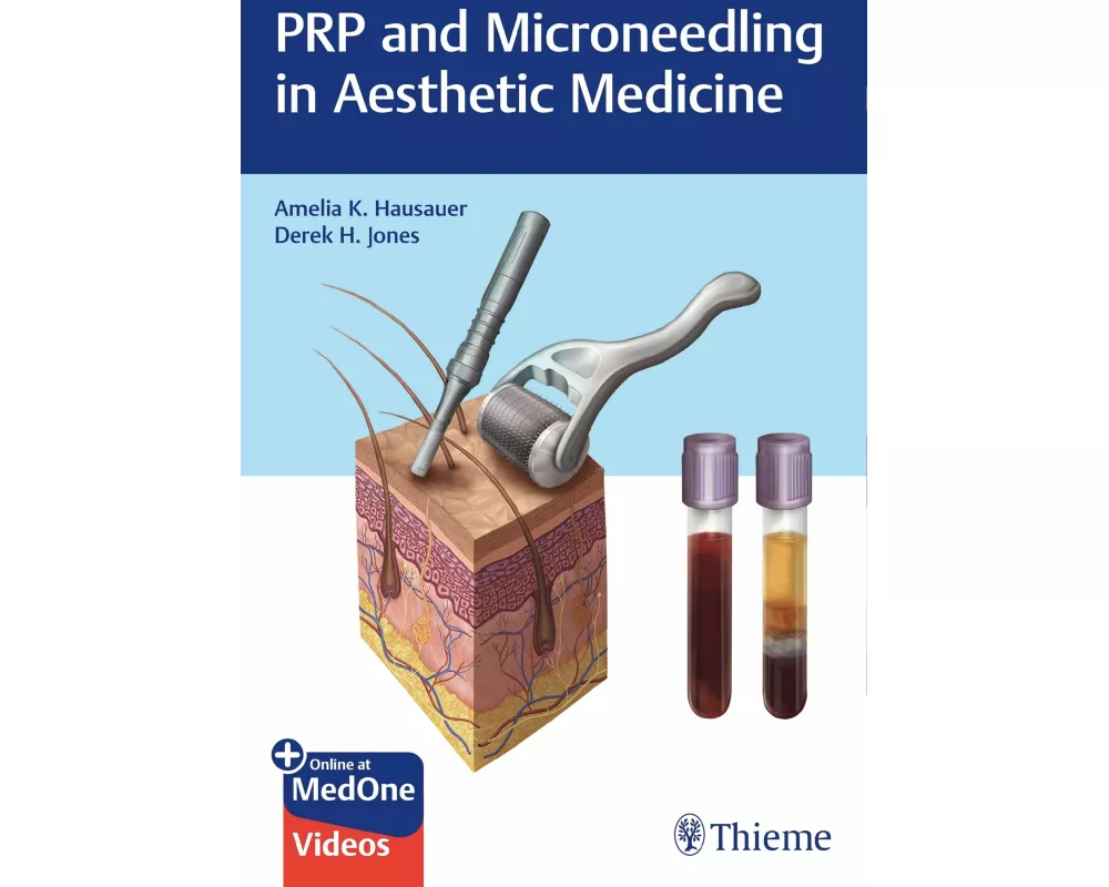 PRP and Microneedling in Aesthetic Medicine