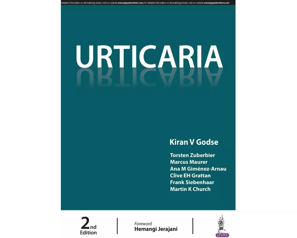 Urticaria