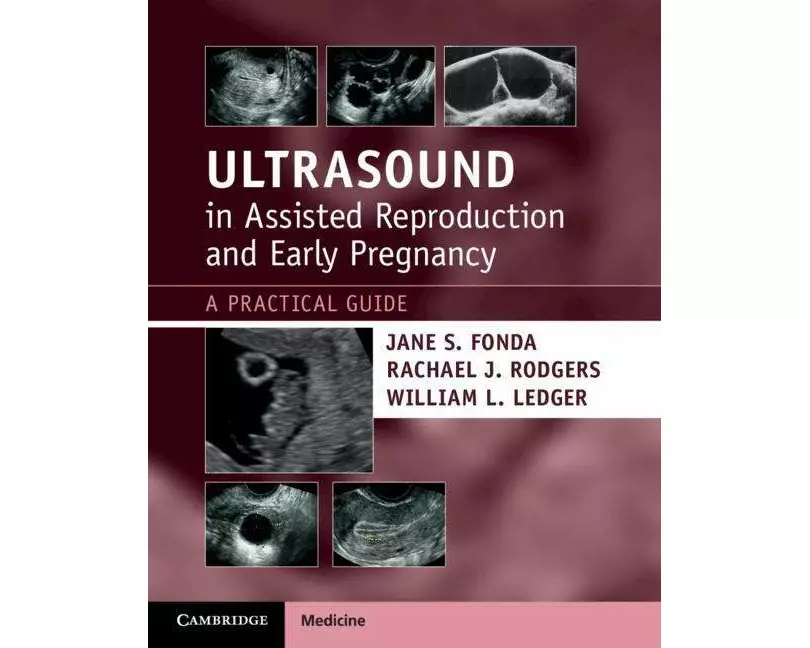 Ultrasound in Assisted Reproduction and Early Pregnancy