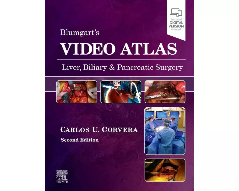 Video Atlas: Liver, Biliary & Pancreatic Surgery