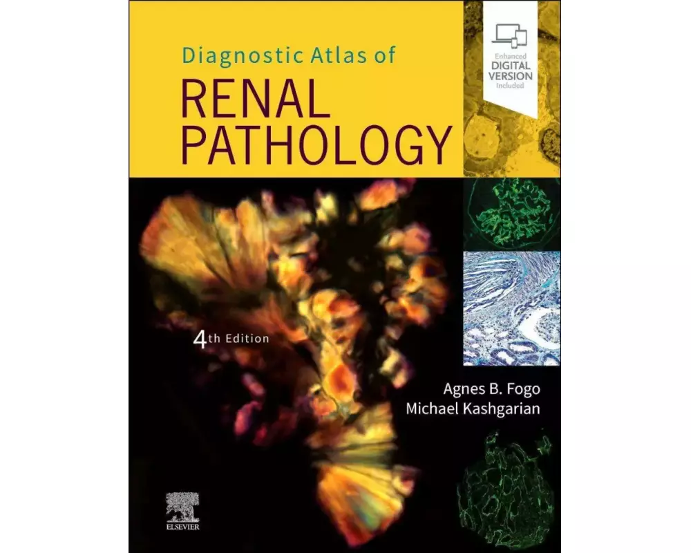 Diagnostic Atlas of Renal Pathology
