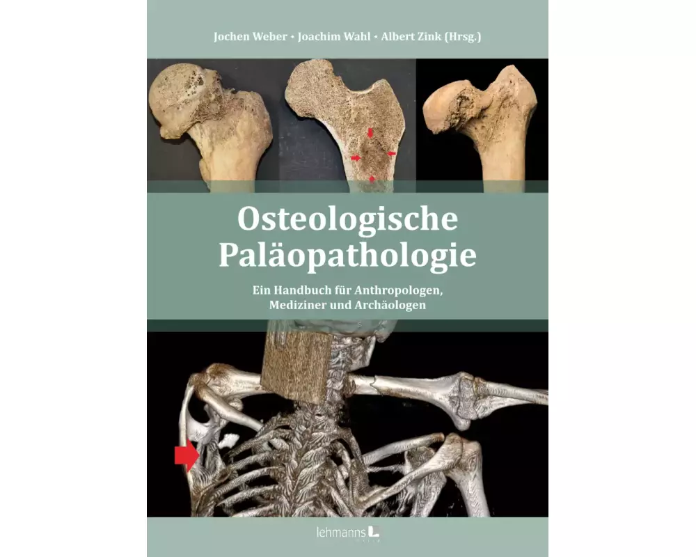 Osteologische Paläopathologie