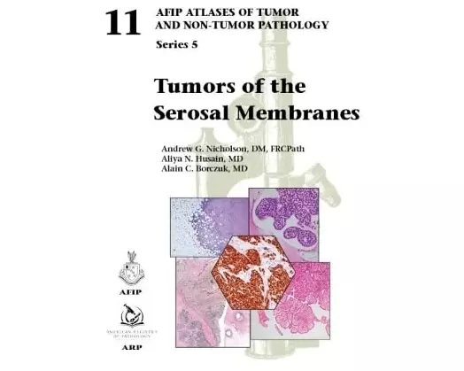 Tumors of the Serosal Membranes