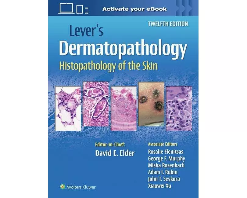 Lever's Dermatopathology: Histopathology of the Skin