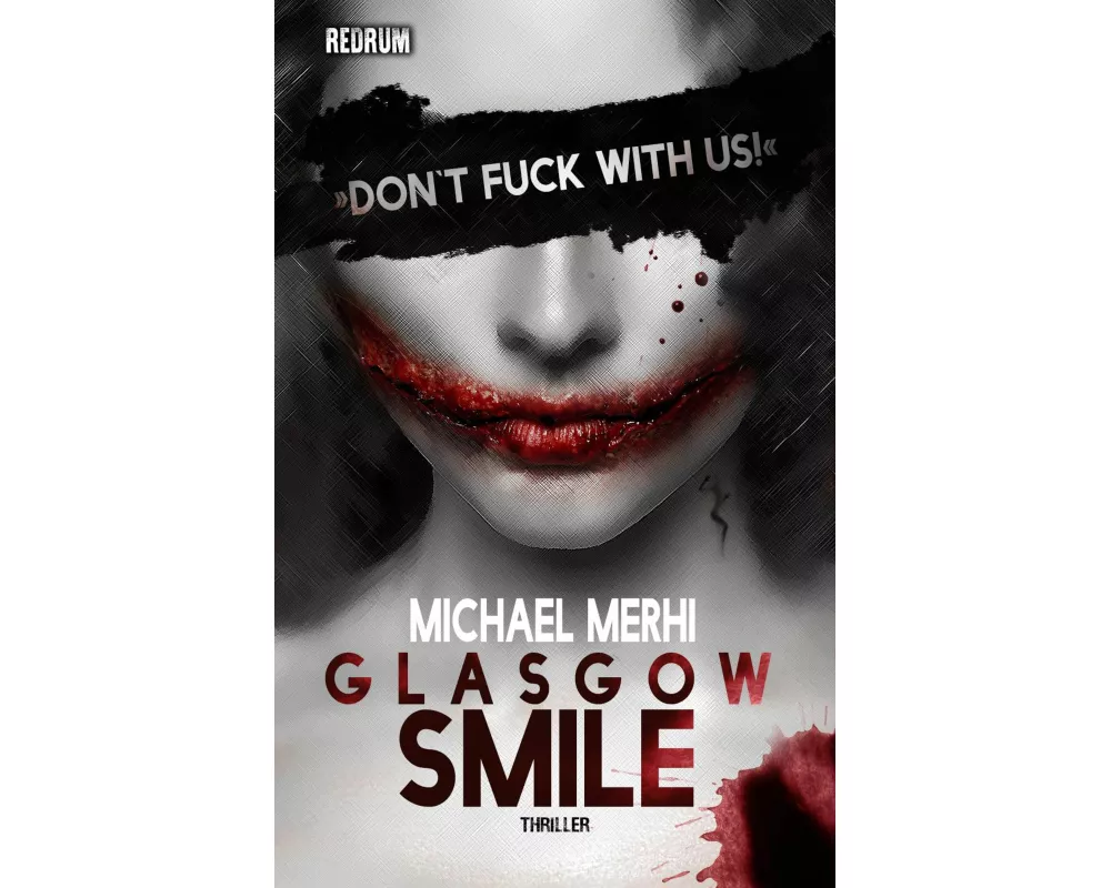 Glasgow Smile