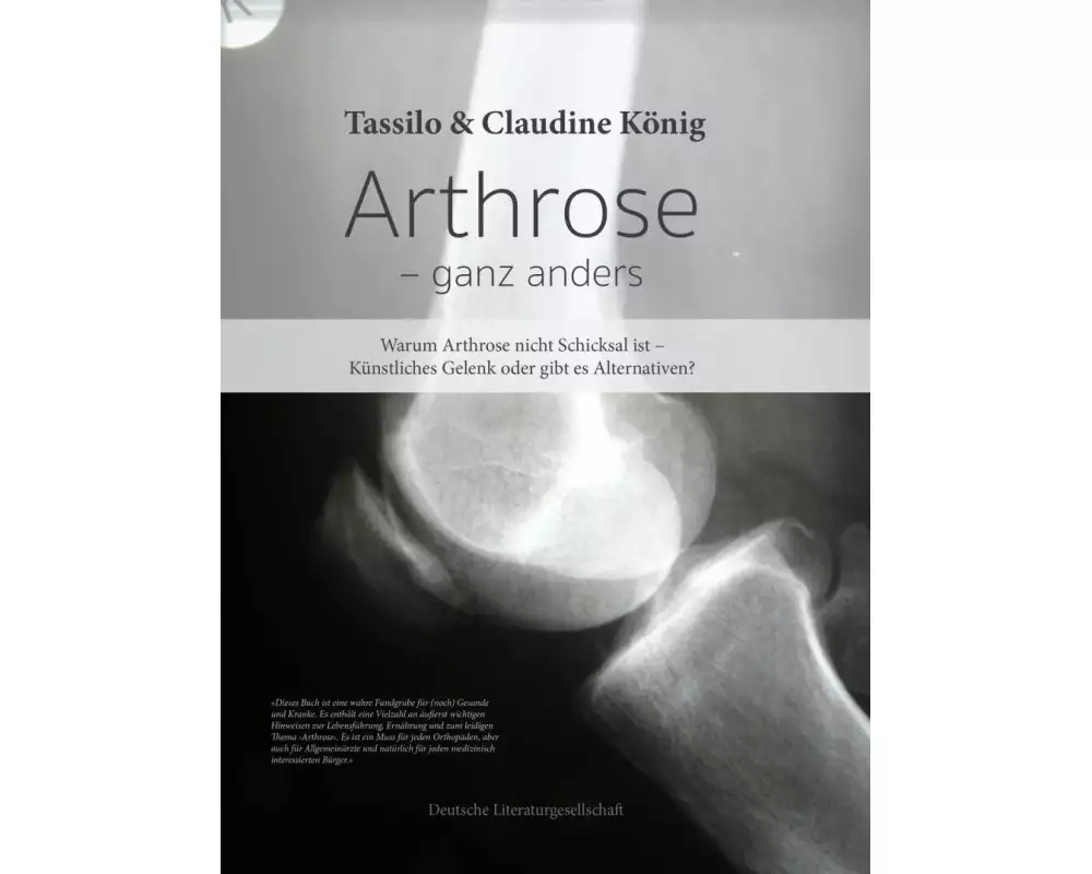 Arthrose – ganz anders